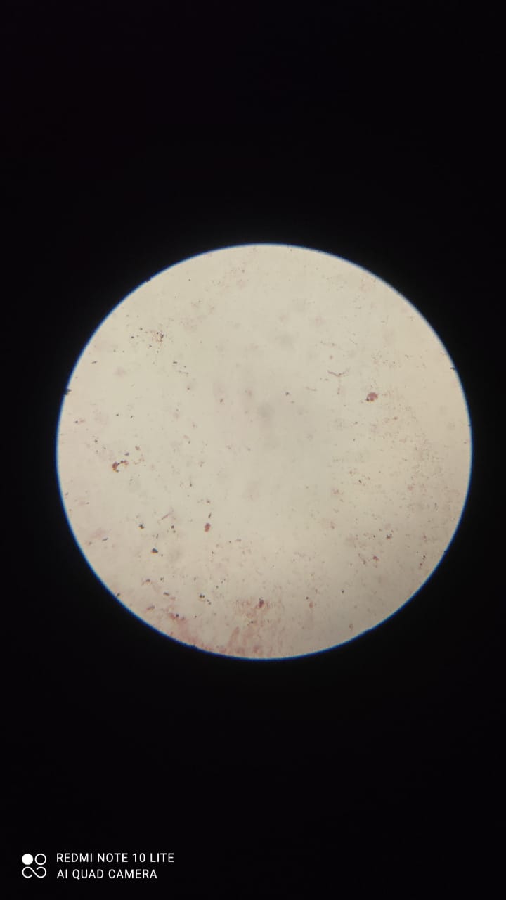 Bacteria grown in Water sample  Near Stat Dept.