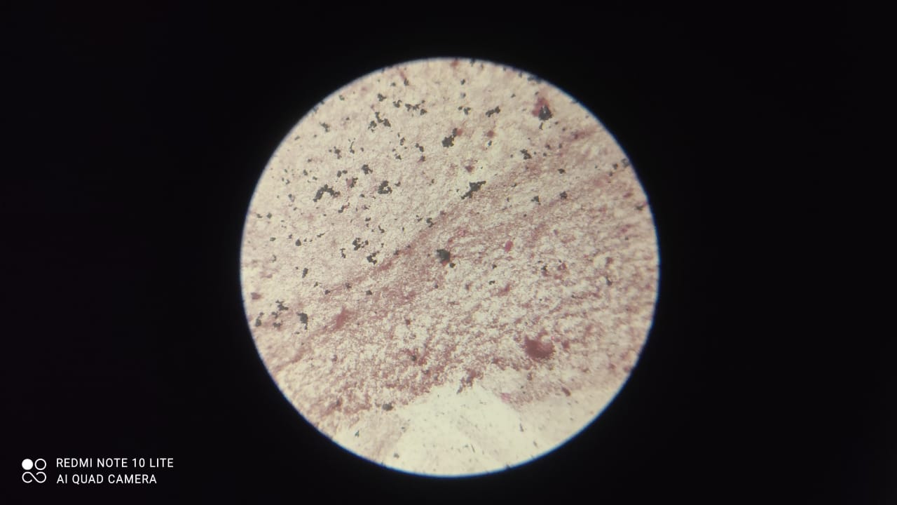 Bacteria grown in Water sample from New Building Ground Floor